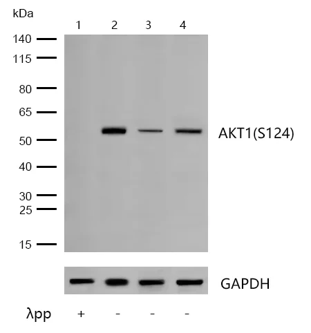 Western blot - Anti-AKT1 (phospho S124) antibody [JJ08-46] (AB326638)