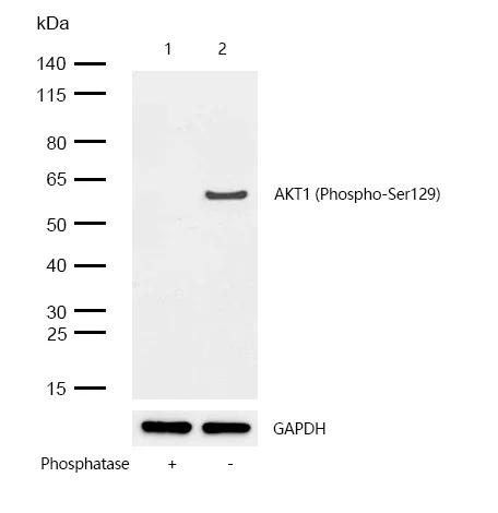 Western blot - Anti-AKT1 (phospho S129) antibody [SR2047] (AB326654)