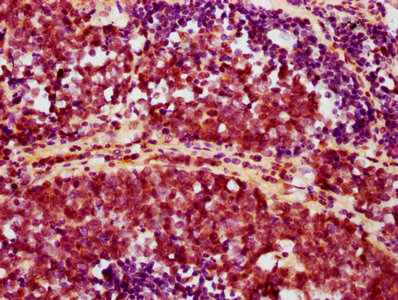 Immunohistochemistry (Formalin/PFA-fixed paraffin-embedded sections) - Anti-AKT1 (phospho S473) antibody [4H12] (AB314038)