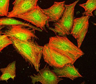 Immunocytochemistry/ Immunofluorescence - Anti-AKT1 (phospho S473) antibody (AB8932)