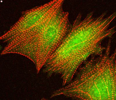 Immunocytochemistry/ Immunofluorescence - Anti-AKT1 (phospho S473) antibody (AB8932)