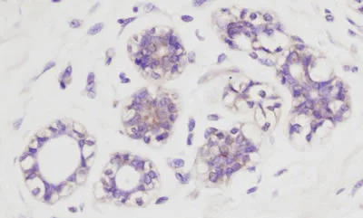 Immunohistochemistry (Formalin/PFA-fixed paraffin-embedded sections) - Anti-AKT1 (phospho S473) antibody (AB8932)