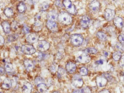 Immunohistochemistry (Formalin/PFA-fixed paraffin-embedded sections) - Anti-AKT1 (phospho S473) antibody (AB8932)