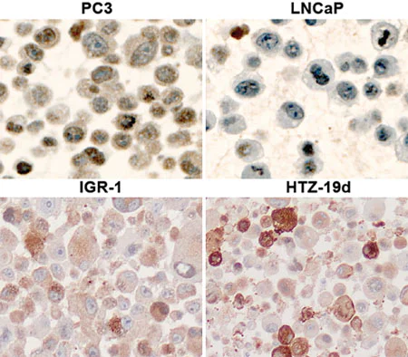Immunohistochemistry (Formalin/PFA-fixed paraffin-embedded sections) - Anti-AKT1 (phospho S473) antibody (AB8932)