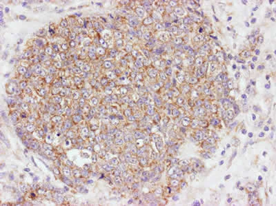 Immunohistochemistry (Formalin/PFA-fixed paraffin-embedded sections) - Anti-AKT1 (phospho S473) antibody (AB8932)