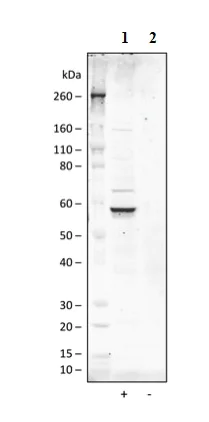 Western blot - Anti-AKT1 (phospho S473) antibody [AktS473-B9] (AB278559)