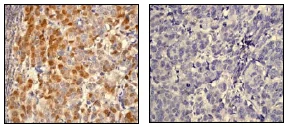 Immunohistochemistry (Formalin/PFA-fixed paraffin-embedded sections) - Anti-AKT1 (phospho S473) antibody [EP2109Y] (AB81283)