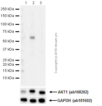 Western blot - Anti-AKT1 (phospho S473) antibody [EP2109Y] (AB81283)