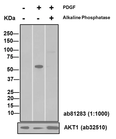 Western blot - Anti-AKT1 (phospho S473) antibody [EP2109Y] (AB81283)