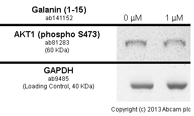 Western blot - Anti-AKT1 (phospho S473) antibody [EP2109Y] (AB81283)