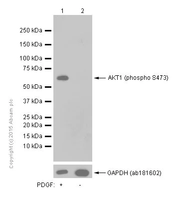 Western blot - Anti-AKT1 (phospho S473) antibody [EP2109Y] (AB81283)