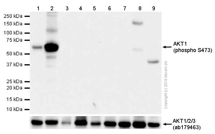 Western blot - Anti-AKT1 (phospho S473) antibody [EP2109Y] (AB81283)