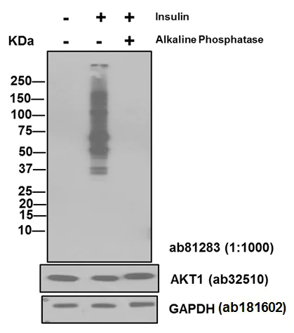 Western blot - Anti-AKT1 (phospho S473) antibody [EP2109Y] (AB81283)
