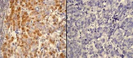 Immunohistochemistry (Formalin/PFA-fixed paraffin-embedded sections) - Anti-AKT1 (phospho S473) antibody [EP2109Y] - BSA and Azide free (AB215873)