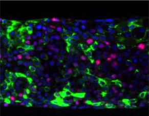 Immunohistochemistry (Formalin/PFA-fixed paraffin-embedded sections) - Anti-AKT1 (phospho S473) antibody [EP2109Y] - BSA and Azide free (AB215873)