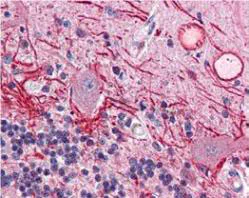 Immunohistochemistry (Formalin/PFA-fixed paraffin-embedded sections) - Anti-AKT1 (phospho T308) antibody [18F3.H11] (AB105731)