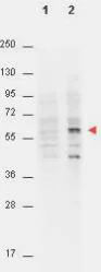 Western blot - Anti-AKT1 (phospho T308) antibody [18F3.H11] (AB105731)