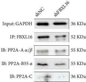 Western blot - Anti-AKT1 (phospho T308) antibody [AktT308-G12] (AB278565)