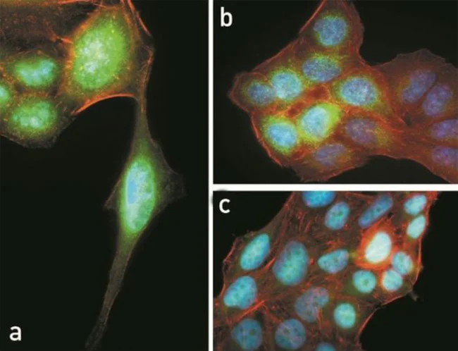 Immunocytochemistry/ Immunofluorescence - Anti-AKT1 (phospho T308) antibody [RP23040021] (AB308100)
