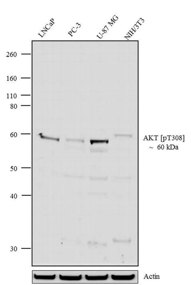Western blot - Anti-AKT1 (phospho T308) antibody [RP23040021] (AB308100)