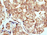 Immunohistochemistry (Formalin/PFA-fixed paraffin-embedded sections) - Anti-AKT1 (phospho T450) antibody [EPR4157] (AB108266)
