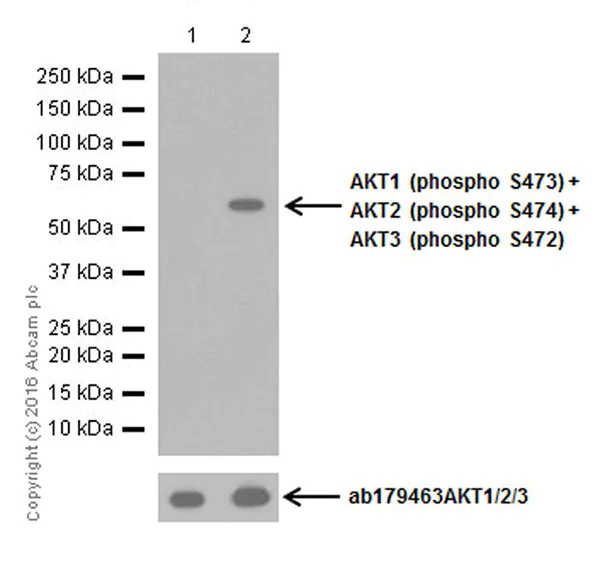Western blot - Anti-AKT1 (pS473) + AKT2 (pS474) + AKT3 (pS472) antibody [EPR18853] (AB192623)