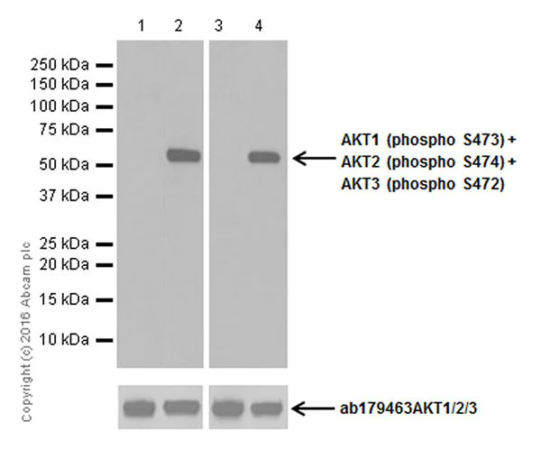 Western blot - Anti-AKT1 (pS473) + AKT2 (pS474) + AKT3 (pS472) antibody [EPR18853] (AB192623)