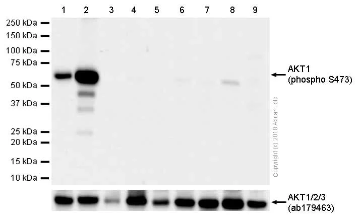 Western blot - Anti-AKT1 (pS473) + AKT2 (pS474) + AKT3 (pS472) antibody [EPR18853] (AB192623)