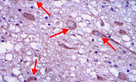 Immunohistochemistry (Formalin/PFA-fixed paraffin-embedded sections) - Anti-AKT2 antibody [4H7] (AB175354)
