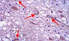 Immunohistochemistry (Formalin/PFA-fixed paraffin-embedded sections) - Anti-AKT2 antibody [4H7] (AB175354)