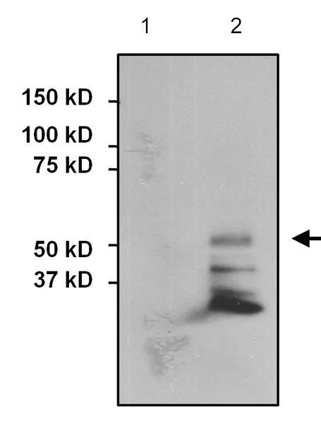 Immunoprecipitation - Anti-AKT2 antibody [4H7] (AB175354)