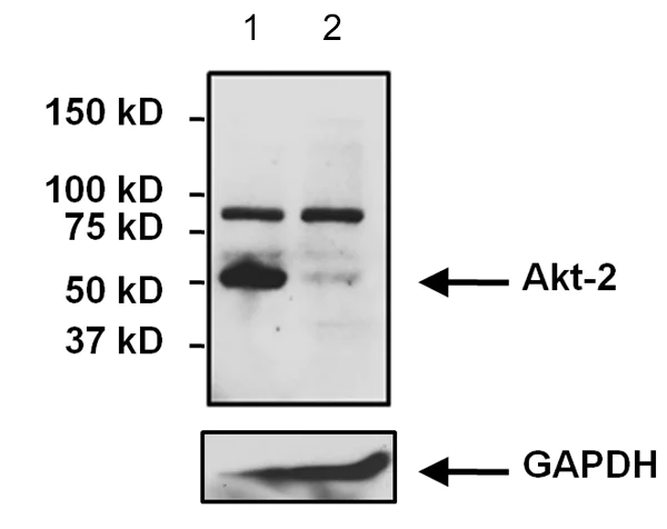 Western blot - Anti-AKT2 antibody [4H7] (AB175354)