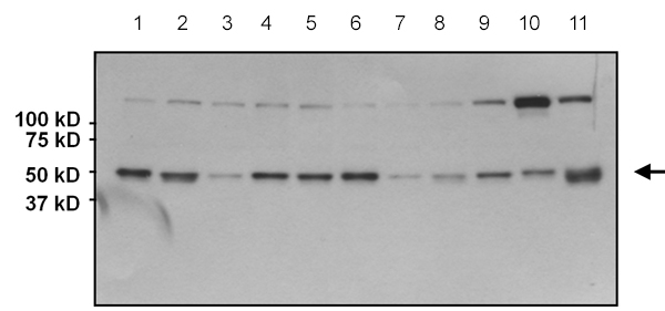 Western blot - Anti-AKT2 antibody [4H7] (AB175354)