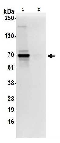 Immunoprecipitation - Anti-AKT2 antibody (AB264288), expandable thumbnail