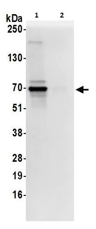 Immunoprecipitation - Anti-AKT2 antibody (AB264288)