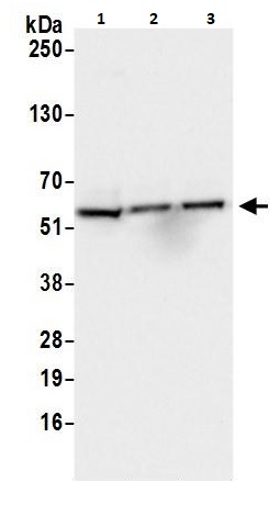 Western blot - Anti-AKT2 antibody (AB264288), expandable thumbnail