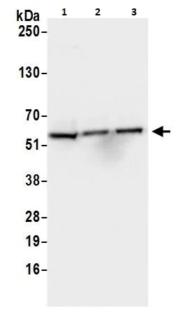 Western blot - Anti-AKT2 antibody (AB264288)