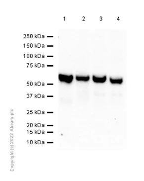 Western blot - Anti-AKT2 antibody [EP1676] (AB131168)