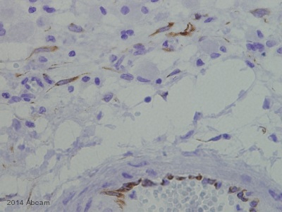 Anti-AKT2 (phospho S474) antibody (ab38513) | Abcam