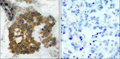 Immunohistochemistry (Formalin/PFA-fixed paraffin-embedded sections) - Anti-AKT2 (phospho S474) antibody (AB38513)