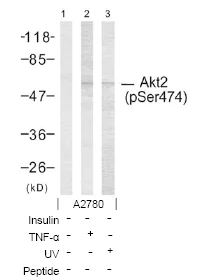 Western blot - Anti-AKT2 (phospho S474) antibody (AB38513)