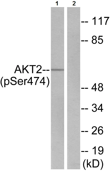 AKT2(磷酸化S474)抗体 (ab38513)| Abcam中文官网