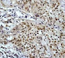Immunohistochemistry (Formalin/PFA-fixed paraffin-embedded sections) - Anti-AKT3 + AKT1 antibody [E45] - BSA and Azide free (AB227994)