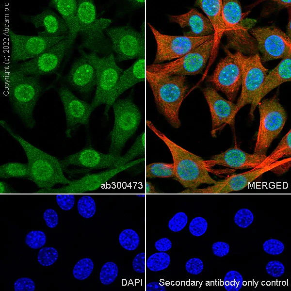 Immunocytochemistry - Anti-AKT3 + AKT2 + AKT1 antibody [RM1043] (AB300473)
