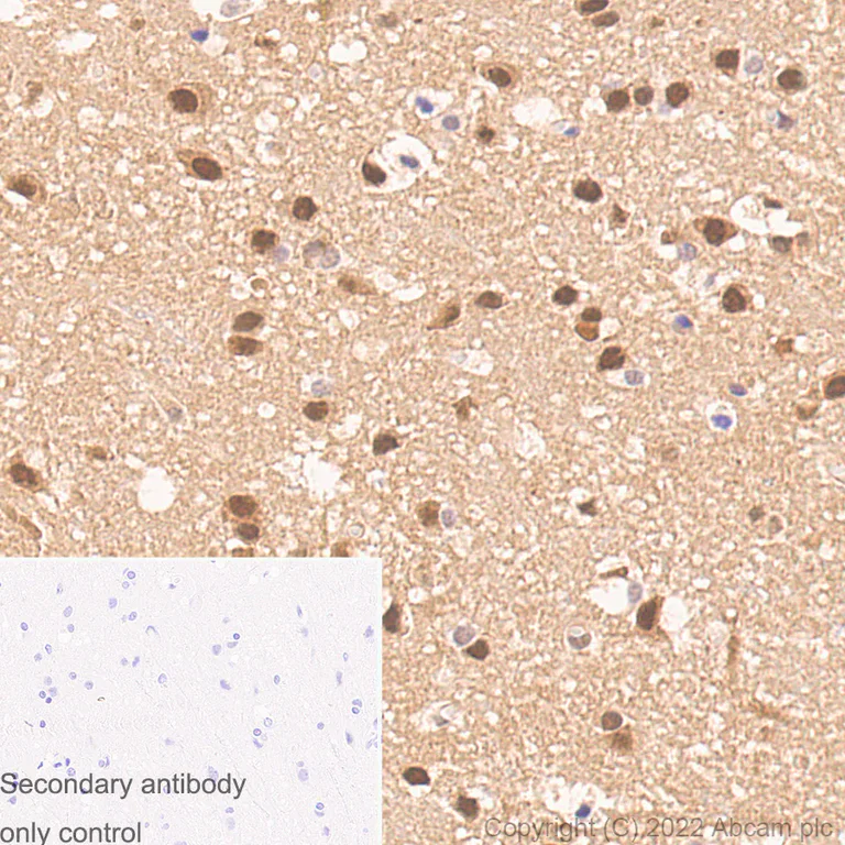 Immunohistochemistry (Formalin/PFA-fixed paraffin-embedded sections) - Anti-AKT3 + AKT2 + AKT1 antibody [RM1043] (AB300473)