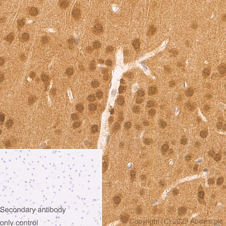 Immunohistochemistry (Formalin/PFA-fixed paraffin-embedded sections) - Anti-AKT3 + AKT2 + AKT1 antibody [RM1043] (AB300473)