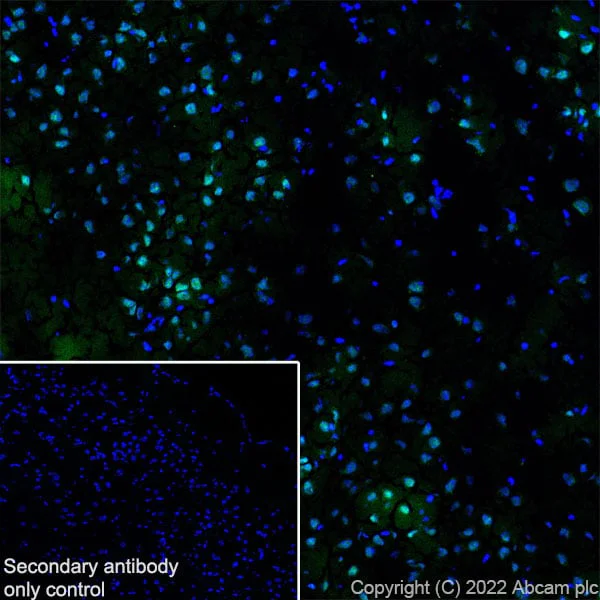 Immunohistochemistry (Frozen sections) - Anti-AKT3 + AKT2 + AKT1 antibody [RM1043] (AB300473)