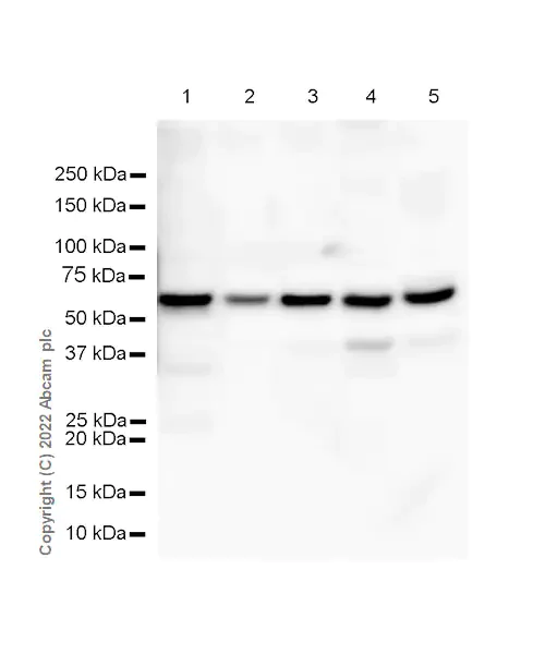 Western blot - Anti-AKT3 + AKT2 + AKT1 antibody [RM1043] (AB300473)