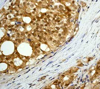 Immunohistochemistry (Formalin/PFA-fixed paraffin-embedded sections) - Anti-AKT3 + AKT2 + AKT1 antibody [Y89] (AB32505)