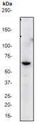Western blot - Anti-AKT3 + AKT2 + AKT1 antibody [Y89] (ab32505), expandable thumbnail